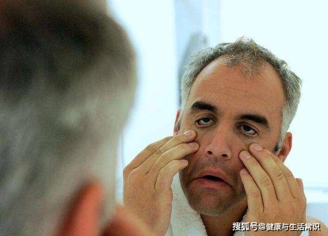 怎么减少头发生长速度 4de2a61e389542179f6283dc1e4764c9.jpeg