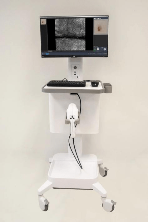 皮肤|曝光了!皮肤CT看到的痘痘竟然是这种画风!