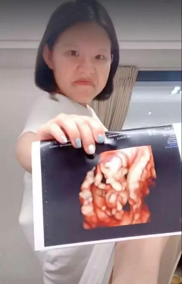 因为|杨幂最丑的姐妹，直播卸妆吓死人，偷偷结婚还要生4个？