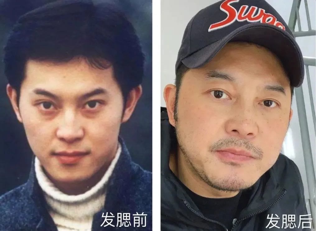 因为脸肿成猪头，神仙姐姐怎么变样儿了？