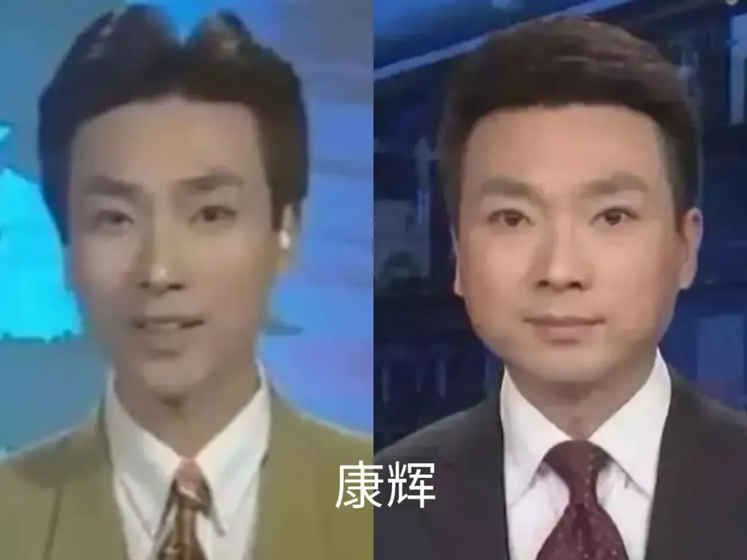 因为脸肿成猪头，神仙姐姐怎么变样儿了？