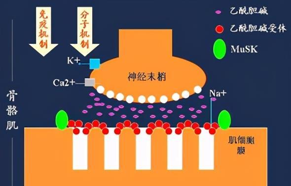 治疗|如何治疗重症肌无力疾病,使用中药治疗效果怎么样呢?