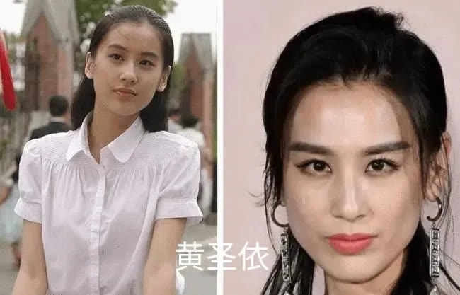 因为脸肿成猪头，神仙姐姐怎么变样儿了？
