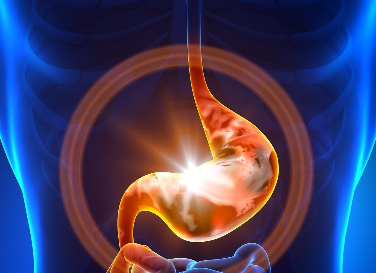 是什么原因引起胃食管反流 27f6a1982e714f6a834020e6f4526b19.jpeg