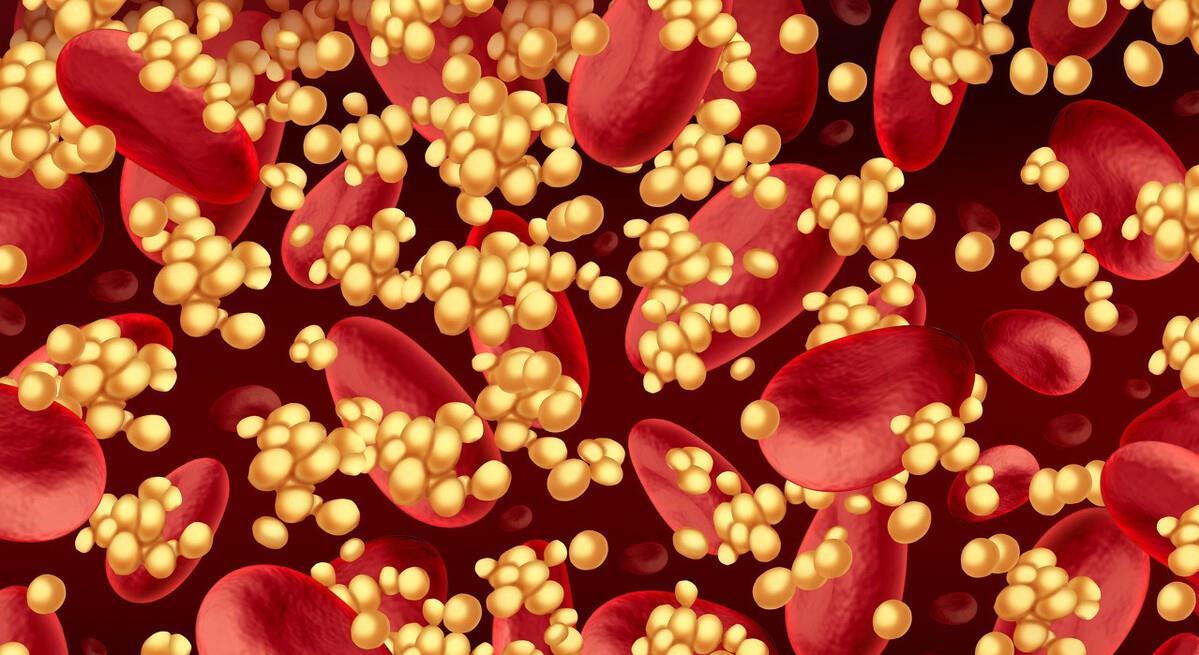 水平|常用的他汀类药物，作用都一样吗，不同的“他汀”有什么区别？