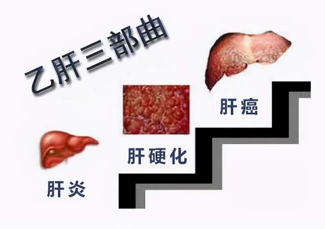 肝炎 症状