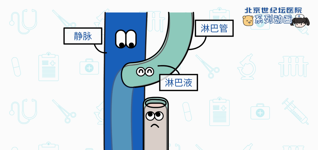 治疗|【科普动画】淋巴管静脉吻合术 术前术后要做啥？