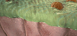 防护|慢阻肺是一场漫长而痛苦的葬礼：进入流感高发季，慢阻肺患者需格外当心！