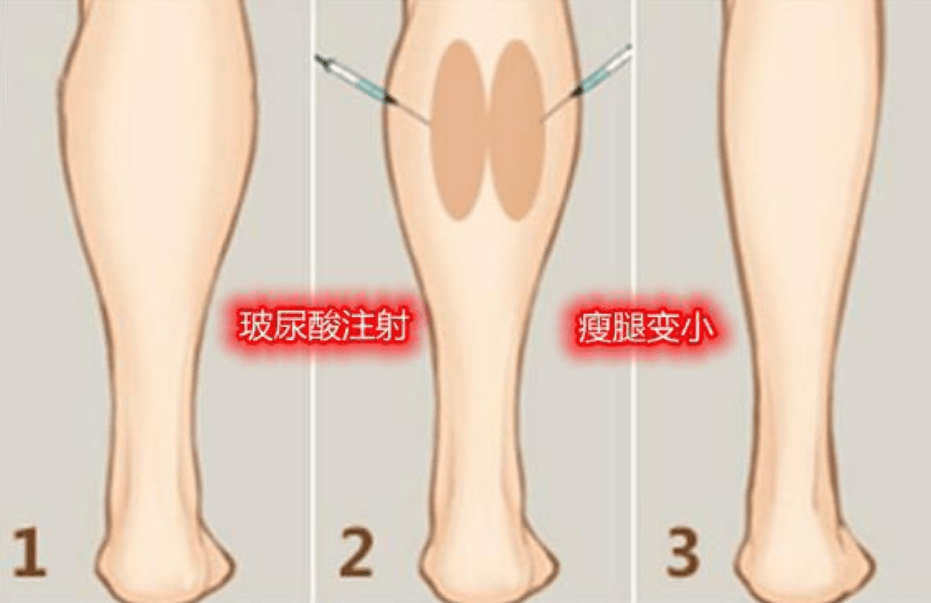 方法花16万断骨增高、催吐、整容低龄化，容貌焦虑正在变得越来越严重