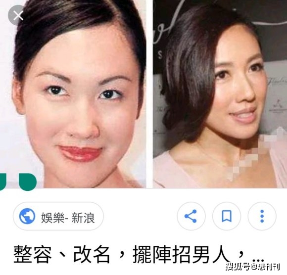 结局整容风刮到香港，这7位港圈大美人竟跑去DO脸上，结局一言难尽