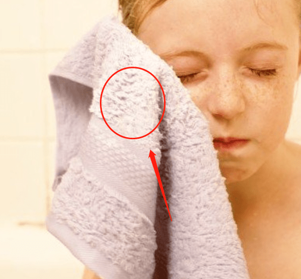 小动作快住手！停下这几个每天烂脸小动作，你的皮肤会一天比一天好！