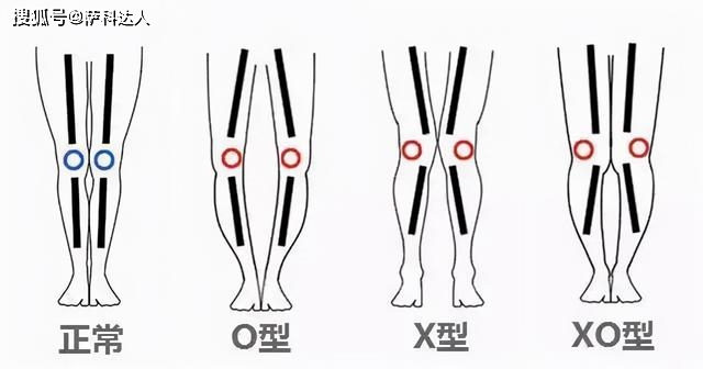 喇叭裤 阔腿裤别穿了吧！今年流行这4条裤子，好看、显瘦又时髦