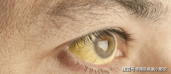 能够帮助|4种食物是肝脏“修复剂”,肝不好的人多吃些,肝脏或会更健康