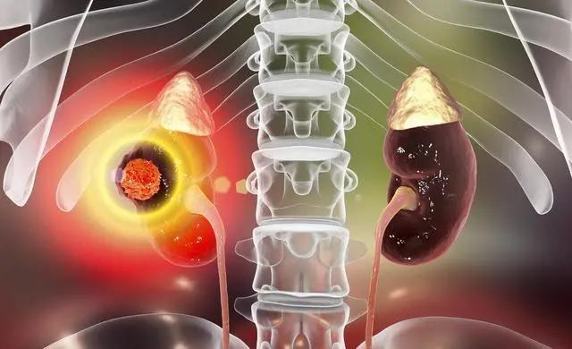 umol|肌酐正常，说明肾脏没有问题吗？