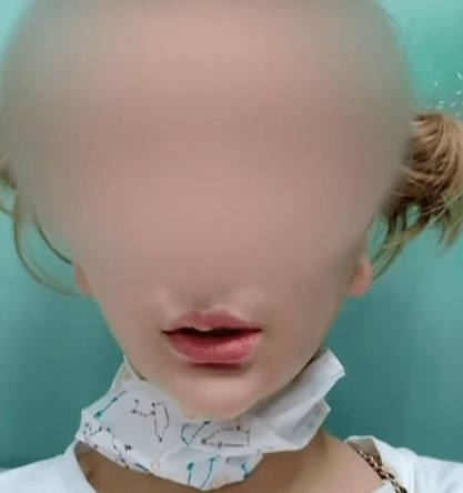 因为女子花1万元做拉皮手术导致面瘫,操刀人曾两次因非法行医被罚