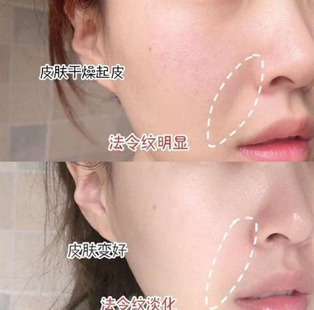 状态洗脸后“爽肤水”直接拍？难怪皮肤差，做好这3点，皮肤细腻水润