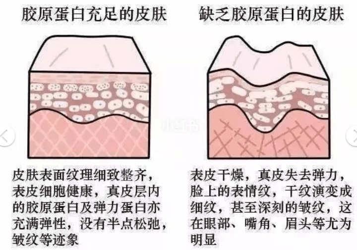 人体谁知道：吃什么补脸上的胶原蛋白？ACME-TEA修复型胶原蛋白效果好