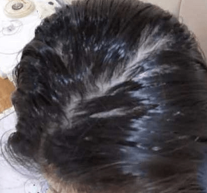 观点评论扒了三十多款洗发水，好用的且有效果的洗发水就3款，孕妈可用