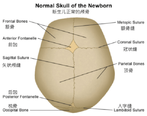 新生儿先天性头颅畸形头颅矫正