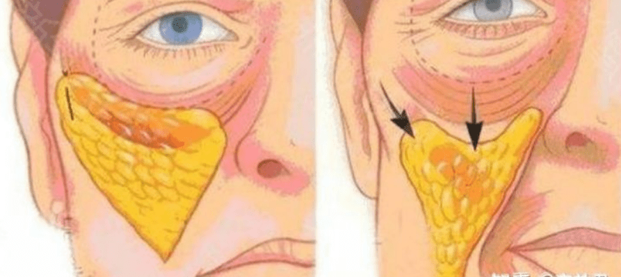玛吉热玛吉是什么原理？揭开天山童姥驻颜的秘密？