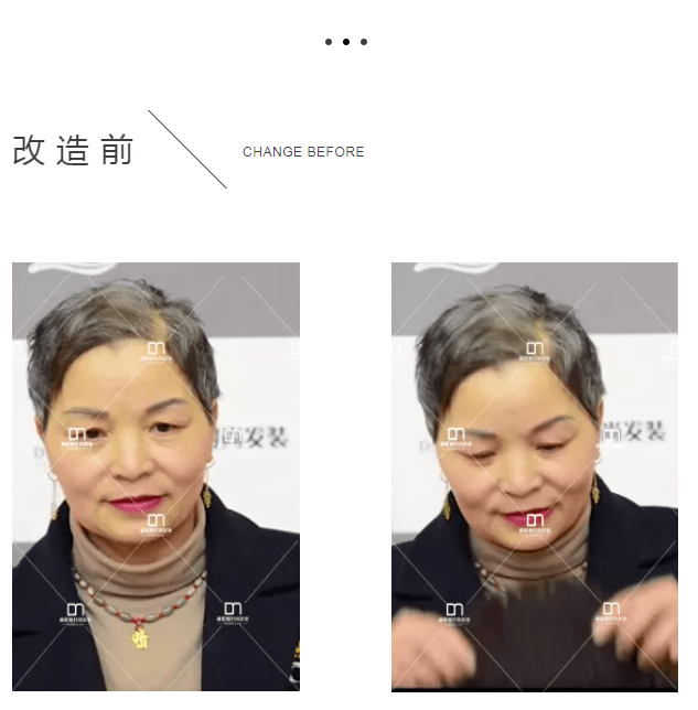 假发脱发后，她果断做了这件“头”等大事！