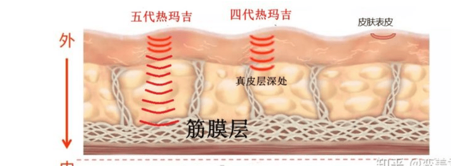 玛吉热玛吉是什么原理？揭开天山童姥驻颜的秘密？
