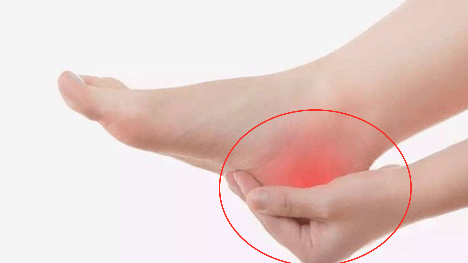 症状|为什么脚痛不能忍？脚后跟痛，忍忍并不会有所改善