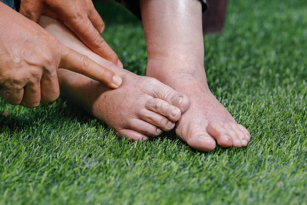 并发症|糖尿病有哪些并发症？一看便知！