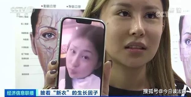 图片女子美容院花6万多注射生长因子，一年后竟变成“长方形脸”