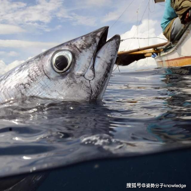 生肉|17岁女孩肠道内发现大量的虫子，寄生虫从何而来？该如何预防