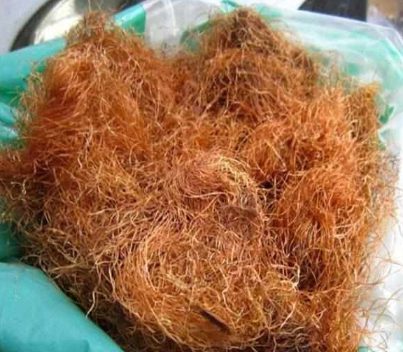 的作用|血糖不稳别着急，天然的“稳糖药”每天吃一点，血糖稳降不再涨！