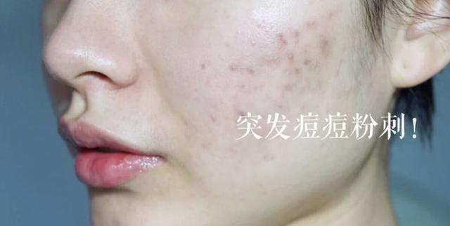 脸蛋国内有一“憋屈”爽肤水，因“提成低”导购很少推荐，其实很好用