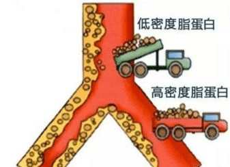 低密度脂蛋白和高密度脂蛋白比例 f04584defc47414a81fb5568fb34a00b.png