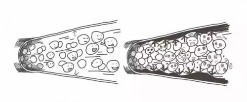 血液|心脑血管疾病的克星——LLT NMN