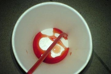 肾脏|肾衰竭的人，身体会发出4个“求救信号”，你若没有，偷偷高兴吧