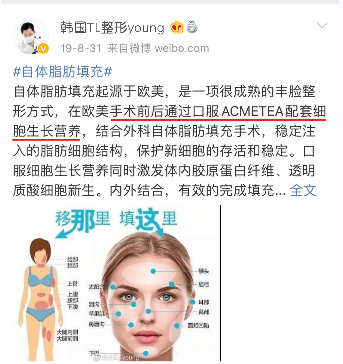 脸部专家科普：脸部做脂肪填充好吗?脸部脂肪填充安全吗?疑问解答~