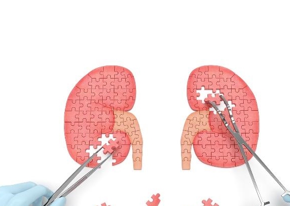 症状|尿蛋白、水肿、贫血，哪个比较容易引起“肾衰”呢？早知道早受益