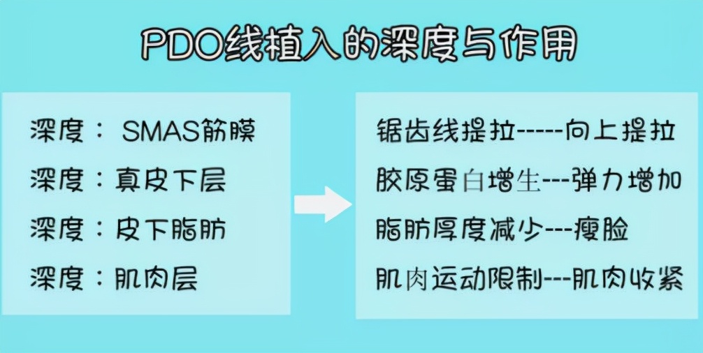 脸部测评！脸部埋线能维持几年？脸部埋线一般多少钱？经验分享！