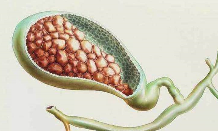 转氨酶|乙肝大三阳，通过治疗转成小三阳，10年没复查，现在肝区隐隐疼