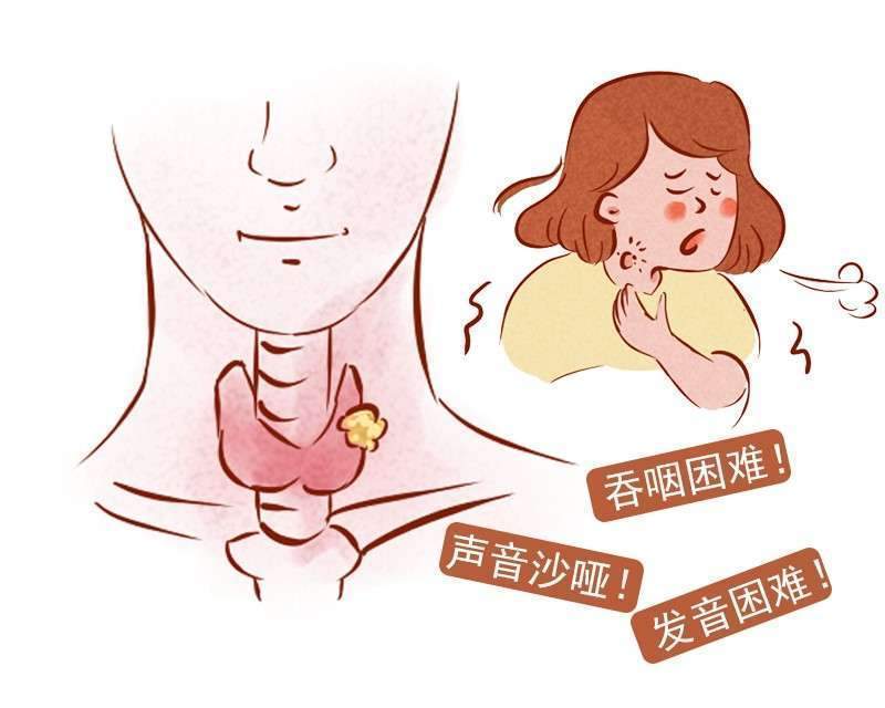 操作|运动神经病后期如何护理?