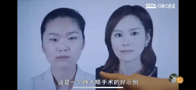 整形二美：整形，一个美丽的“陷阱”