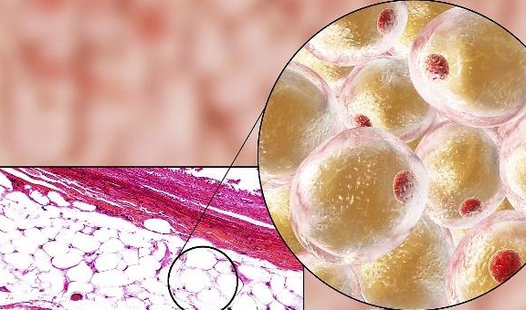 关系|血糖高,与这8个环节有很大关系,找出原因帮你更好的控制血糖