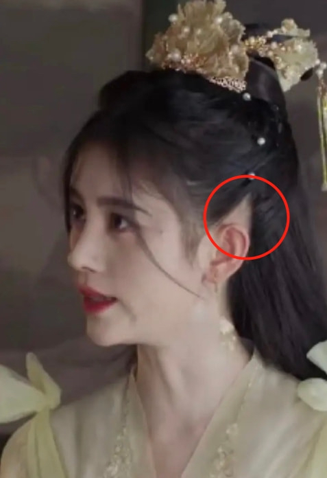 假发|她耳后斑秃？