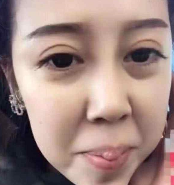 因为抖音小姐姐唇珠奇大，想到了当年的嘟嘟姐，网友：好想薅下来！