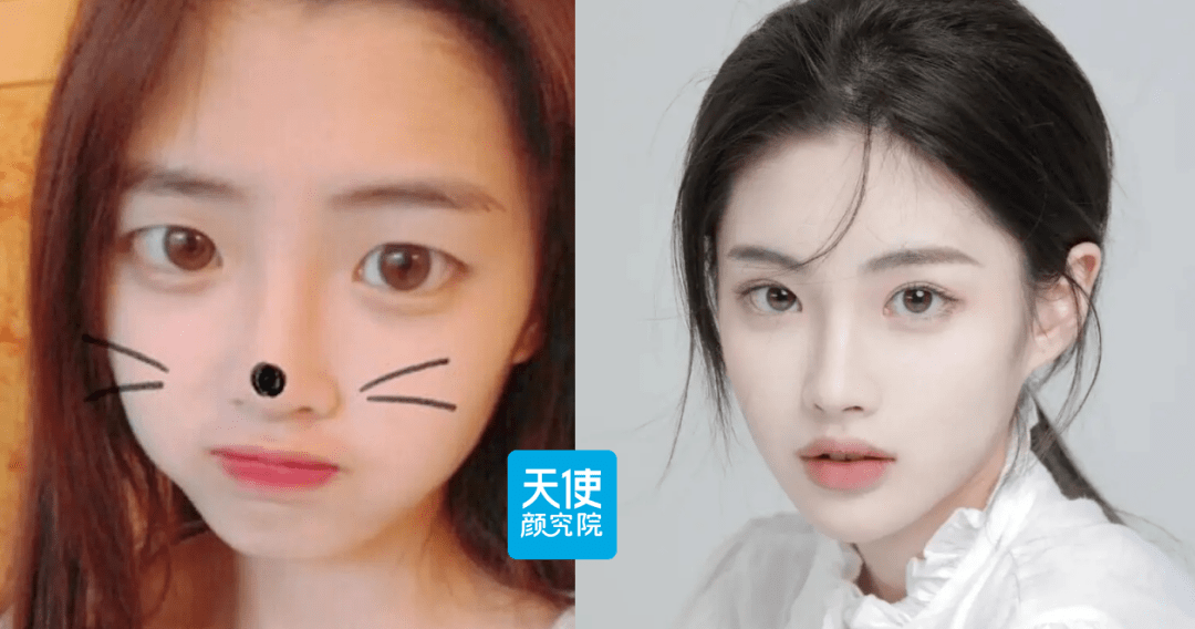 人造孙一宁半藏森林她用脑子整出了全网唯一的贵气千金脸