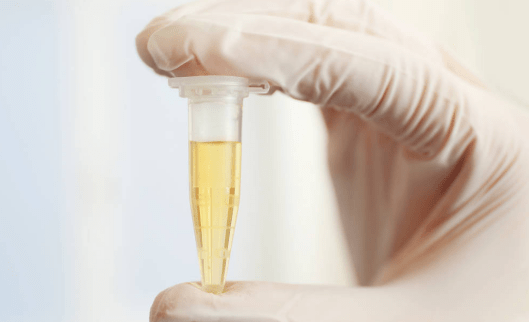 寿安|医生提醒：患上糖尿病，这“3”食物能算得上是“升糖剂”，能不吃就不吃