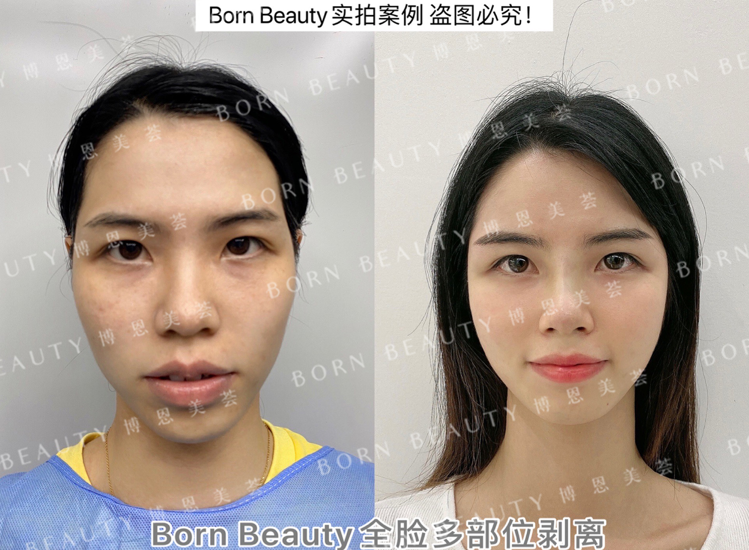 路线清纯小花怎么变成这样了？她到底动了哪里？