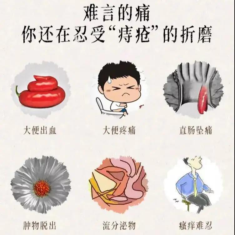 痔疮怎么预防?这四点很重要_直肠