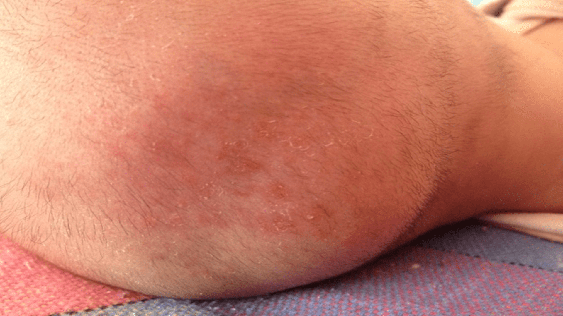 枕头|2.8万“头盔”变美婴儿头？家长的爱美焦虑，会影响到孩子发育