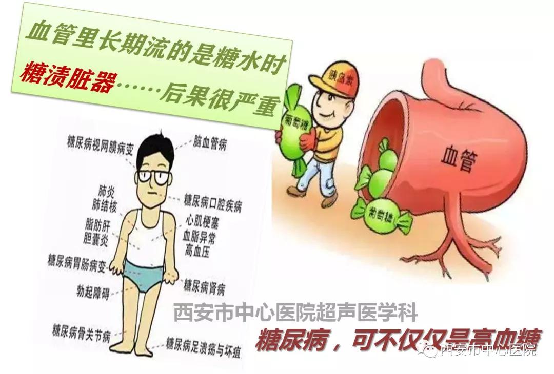 医学科|这帮彩超医师为了糖友，也是拼了！